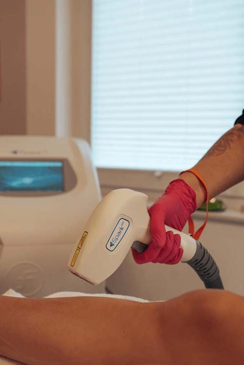 Laserbehandlung Haarentfernung Kreis Höxter Detmold