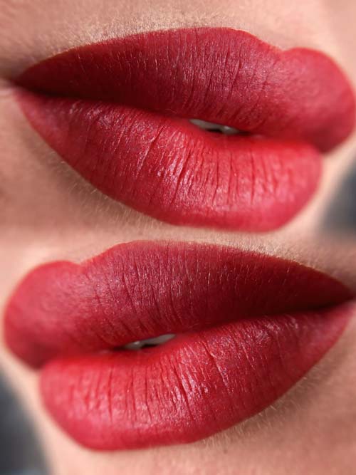 Lippen verschönern Kosten